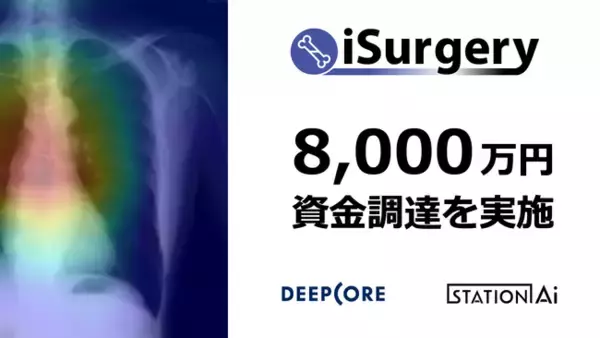骨粗しょう症検診用AI医療機器を開発する医療ベンチャー iSurgery株式会社が第三者割当増資にて8,000万円の資金調達を実施