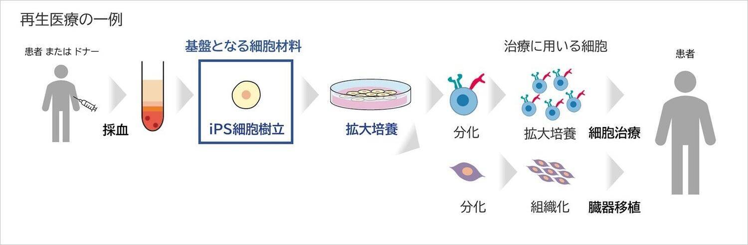 iPS細胞樹立工程の自動化で、再生医療をより身近なものに―― 一人ひとりに適した治療の実現へ