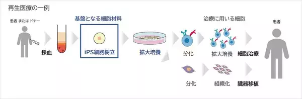 「iPS細胞樹立工程の自動化で、再生医療をより身近なものに―― 一人ひとりに適した治療の実現へ」の画像