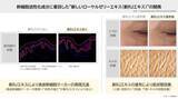 「ローヤルゼリーに新知見　肌の角層水分量と真皮の厚みを向上させ、シワやキメを改善独自」の画像1