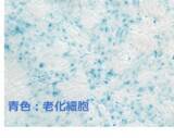 「世界初！キリンと東京大学が、ヒトiPS細胞由来小腸オルガノイドを用いた老化抑制素材の有効性確認に成功」の画像1