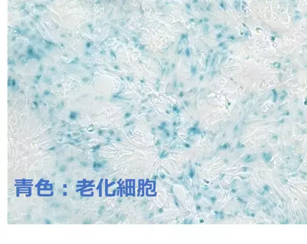 世界初！キリンと東京大学が、ヒトiPS細胞由来小腸オルガノイドを用いた老化抑制素材の有効性確認に成功