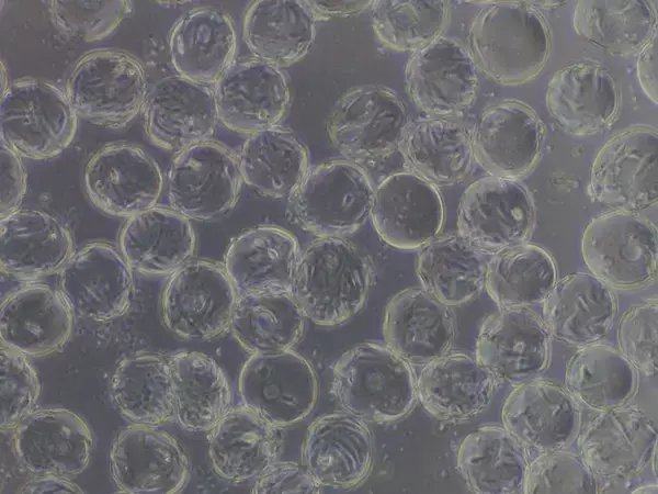 再生医療向けの細胞培養で用いる可溶性マイクロキャリア（微小粒子）を開発