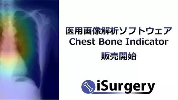 胸部X線写真から骨を検査するAI医療機器「医用画像解析ソフトウェア Chest Bone Indicator」販売開始