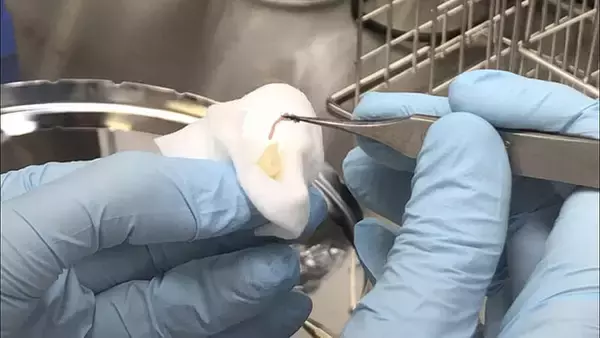 「「死んだ歯を蘇らせる」って本当ですか？！2020年に日本で承認された歯髄再生治療を埼玉県で初導入」の画像