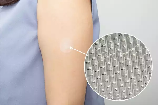 「注射に代わるマイクロニードルは「痛くない」だけなのか？高校二年生が探求した「やさしい医療」」の画像