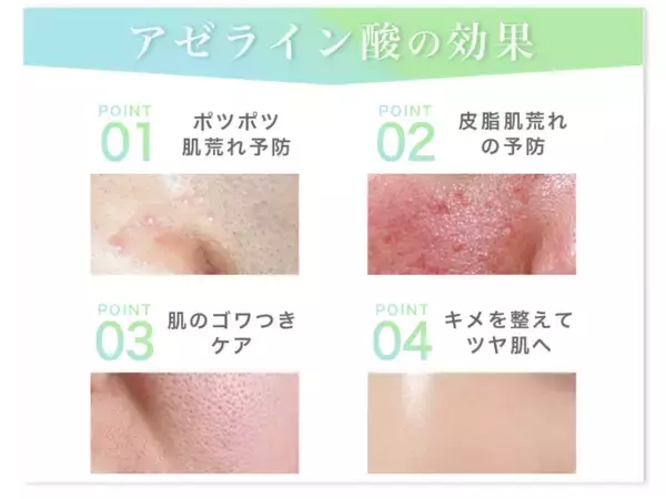 【4/7（火）再販開始】先行販売後３日で完売した、敏感肌のための新アゼライン酸美容液が再入荷。春夏の肌荒れ予防として注目。