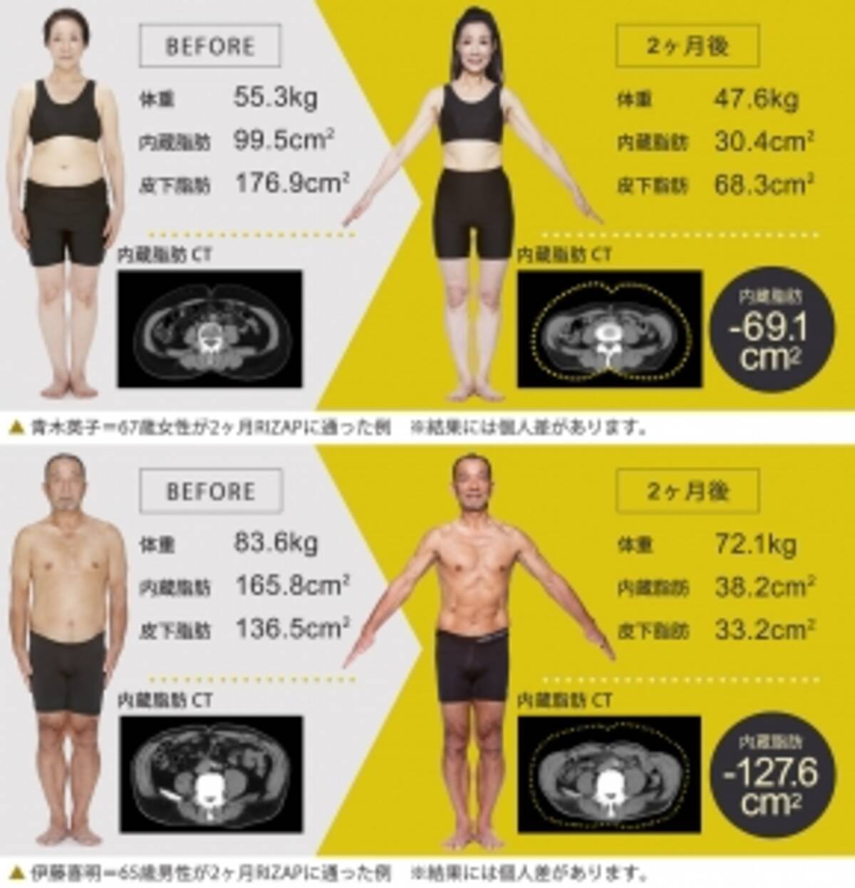 シニア世代もライザップに挑戦 60代でも結果にコミット シニアモニターが驚異の 11 5kg達成 15年8月17日 エキサイトニュース