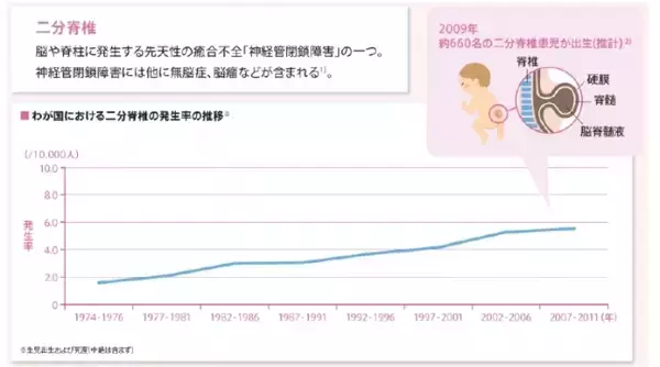 ＮＴＤｓを減らしたい！　赤ちゃんのために妊娠前からできることバイエル薬品　神経管閉鎖障害（NTDs）の発症リスク低減の啓発活動開始