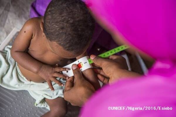 ナイジェリア ボルノ州 子ども約25万人が重度の栄養不良 プレスリリース 16年7月19日 エキサイトニュース