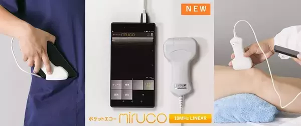 税別29.8万円から導入可能「ポケットエコー miruco（ミルコ）」にリニアプローブ搭載モデルを追加発売