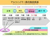 「日本認知症予防学会 エビデンス創出委員会がTwendee Xをサプリメント初の「グレードA （★★★）」に認定」の画像1