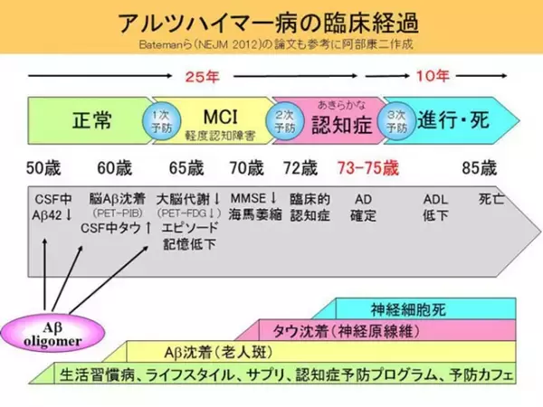 日本認知症予防学会 エビデンス創出委員会がTwendee Xをサプリメント初の「グレードA （★★★）」に認定