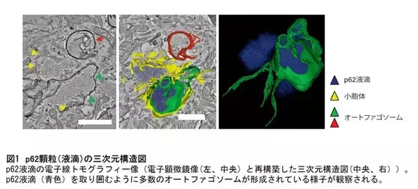 非膜型細胞小器官p62顆粒の機能を解明