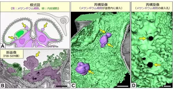 電子顕微鏡像の3D再構築技術により糸球体内皮細胞の正常構造を完全解明