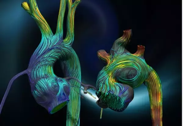 血流シミュレーションによる先天性心臓疾患の手術設計技術が、AMEDの「医療機器開発推進研究事業」に採択されました