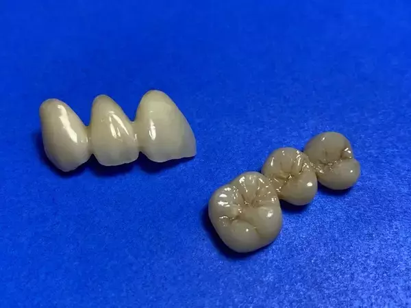 技術に定評のある神戸の歯科技工所「K.D.A Laboratory」がメタルフリー義歯（金属を使わない白い歯）の提供を非対面で開始しました！