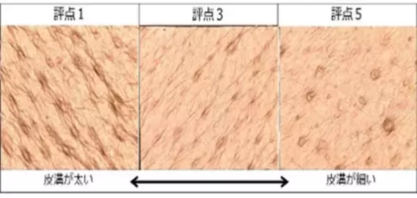 肌の老化と状態の目安、肌理（きめ）の評価方法を確立