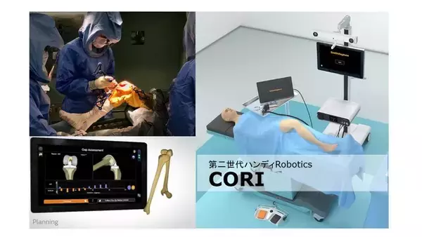 【富永病院整形外科】人工関節置換術に使用する次世代型赤外線誘導式手術支援ロボットCORI(Smith &Nephew 社製)を導入