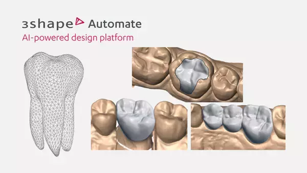 国内累計25万症例を突破、AIによる歯科修復物デザイン。3Shape「Automate」が歯科技工所の生産性向上をサポート。