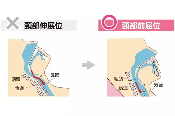 「医療・介護を取り巻く環境にもっと笑顔を──シーホネンス 70年の歩み・創業の志と常に挑戦する開発型メーカーの系譜」の画像