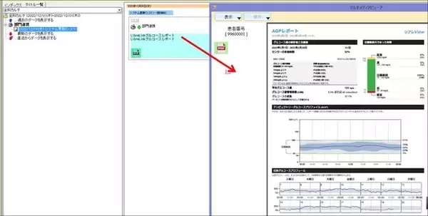 診療録直結型全国糖尿病データベース事業J-DREAMSにアボットのFreeStyleリブレ(R)システムが持続グルコース測定システムとして初めてデータ連携