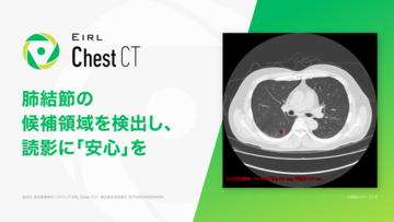 胸部CT画像診断支援AI「EIRL Chest CT」、計測機能の拡充機能等を追加した新モデルを発売