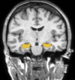 「東北大学 加齢医学研究所 発ベンチャーのCogSmart、“海馬を育てる”日本発ソリューションの展開のため、株式投資型クラウドファンディングを実施」の画像1