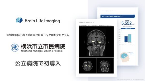 公立病院として初 認知機能低下の予防に向けた脳ドック用aiプログラム Brain Life Imaging R が横浜市立市民病院に導入 22年4月5日 エキサイトニュース