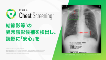 胸部X線診断支援AI「EIRL Chest Screening」を大幅アップデート