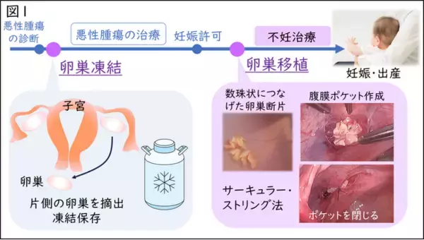 移植卵巣から得た卵子による妊娠・出産に成功