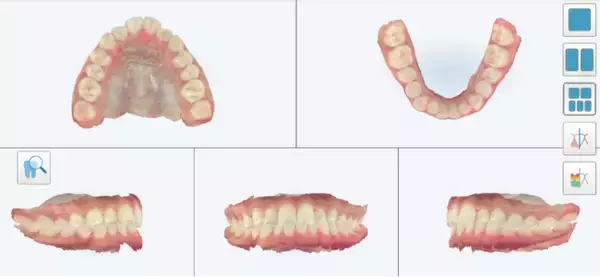 フェイススキャン・iTero・3D CTで「見える矯正」を実現。　　　　河底歯科・矯正歯科が3Dデジタル精密診断を本格展開