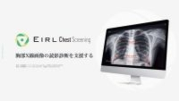 胸部X線画像の読影診断を支援するEIRL Chest Screening、感度優先／特異度優先の選択ができる新モデルを発売