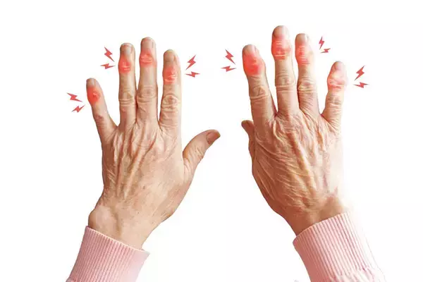 「治療法がないと言われた患者さんを慢性的な痛みから救いたい。痛みの原因「モヤモヤ血管」に注目した画期的な治療法『動注治療』を開発するまでのストーリー」の画像