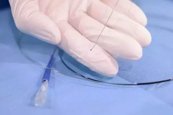 「治療法がないと言われた患者さんを慢性的な痛みから救いたい。痛みの原因「モヤモヤ血管」に注目した画期的な治療法『動注治療』を開発するまでのストーリー」の画像