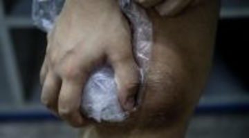 「サッカーしてないのにサッカー選手みたいな怪我しました…手術こわい」Jリーガーと結婚した美人ドラマー妻が緊急手術