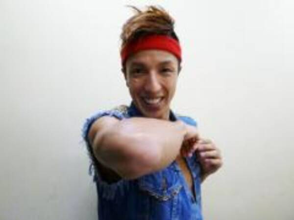 2700のツネ 全治2週間の火傷 2014年10月31日 エキサイトニュース