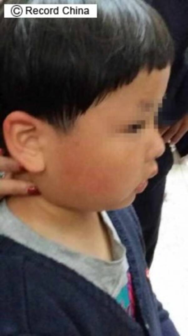6歳の男の子に平手打ち 外国人女性が10日間の行政拘留処分 中国 14年2月7日 エキサイトニュース