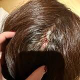 「香港の女優、日本の温泉で転倒し頭部を負傷―香港メディア」の画像2