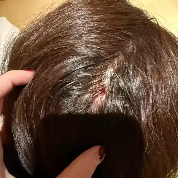 「香港の女優、日本の温泉で転倒し頭部を負傷―香港メディア」の画像