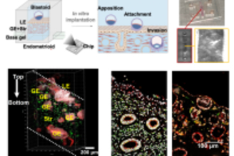 中国と外国の共同チーム、ヒト胚着床過程を実験室で初めて再現