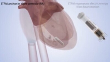 心臓の鼓動で自ら発電するペースメーカーの開発に成功―中国