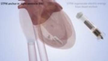 心臓の鼓動で自ら発電するペースメーカーの開発に成功―中国