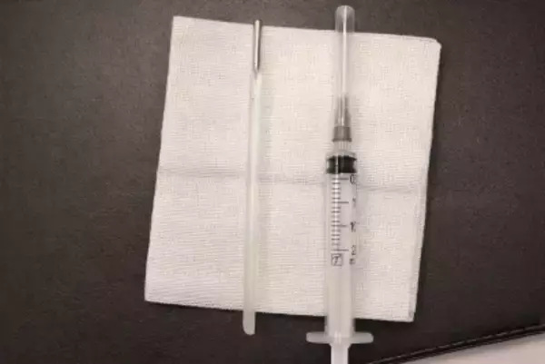 腹痛で病院に駆け込んだ男性、腸内から水銀体温計―中国