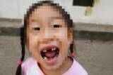 「ロボットに蹴られた5歳女児、歯が4本抜ける―中国」の画像1