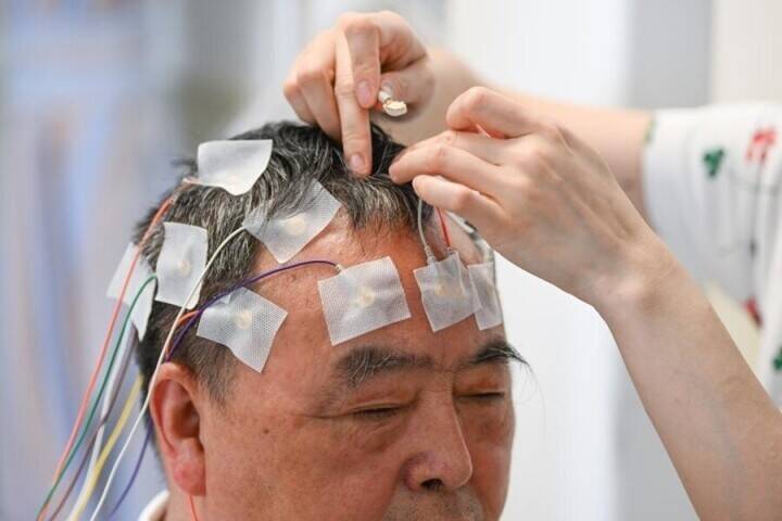 中国南西部初のBMI研究型病棟、「意識によるコントロール」のリハビリ治療を実施―重慶市