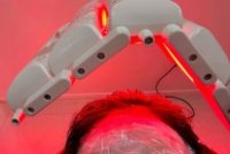 韓国は脱毛症治療の保険適用を検討、中国も「他人事」ではない―中国メディア