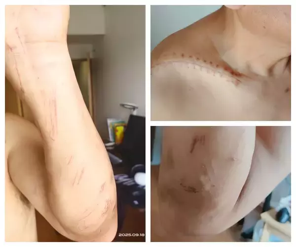 「「中日関係が良くなくても、人命救助に国境はない」―在日中国人団体が交流会開催、日本で人命救助の楊波氏も出席」の画像