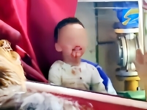 10階から転落し助かった3歳児、抱っこをせがむも誰も抱き上げず―中国