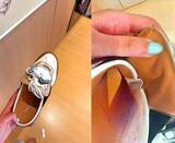 「「10分履いただけで足に傷」、女性がLVにクレーム＝中国ネット「金持ちが賢いとは限らない」」の画像1